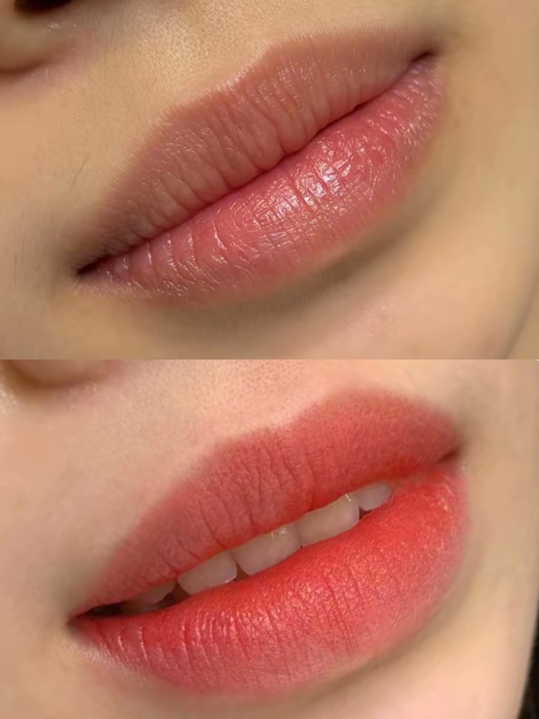 Lips